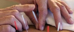 acupuntura-teofilo-otoni-1353234012